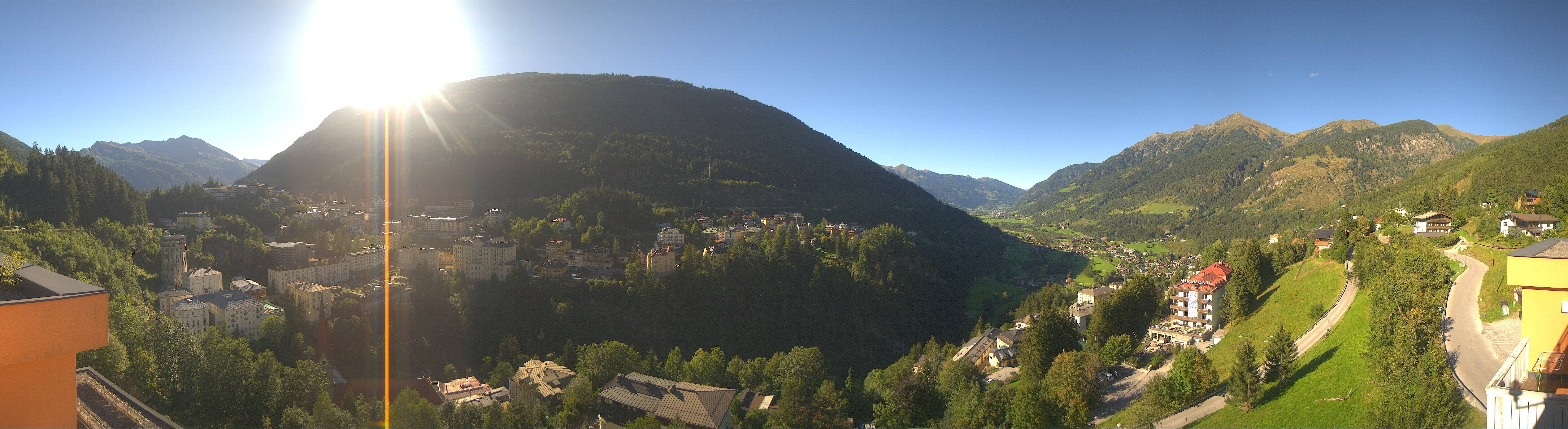 Archived image Webcam Hotel Schillerhof in Bad Gastein
