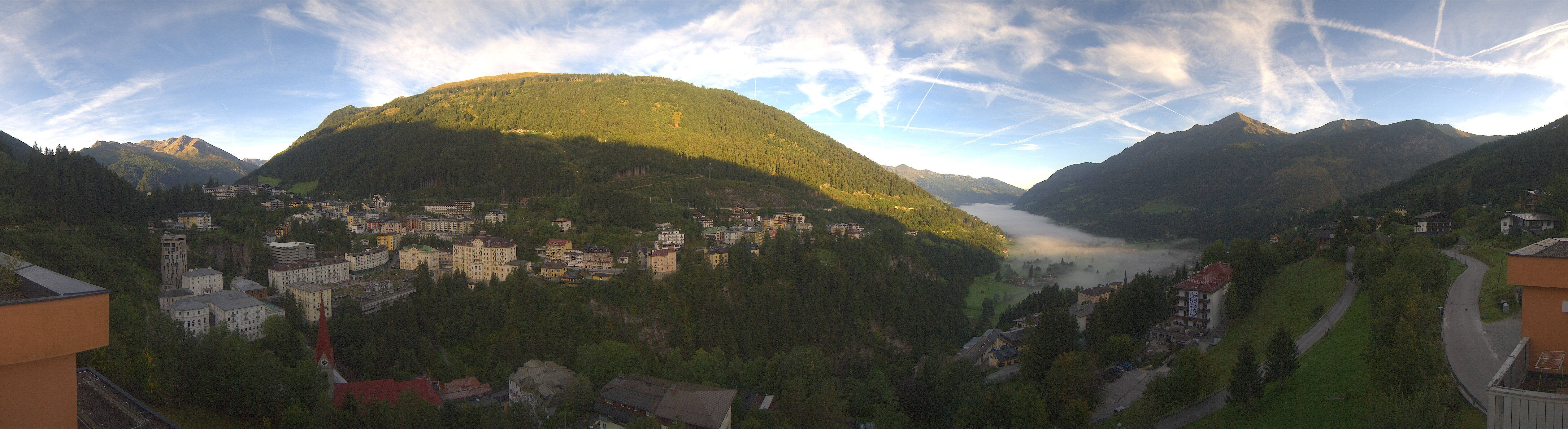 Archived image Webcam Hotel Schillerhof in Bad Gastein