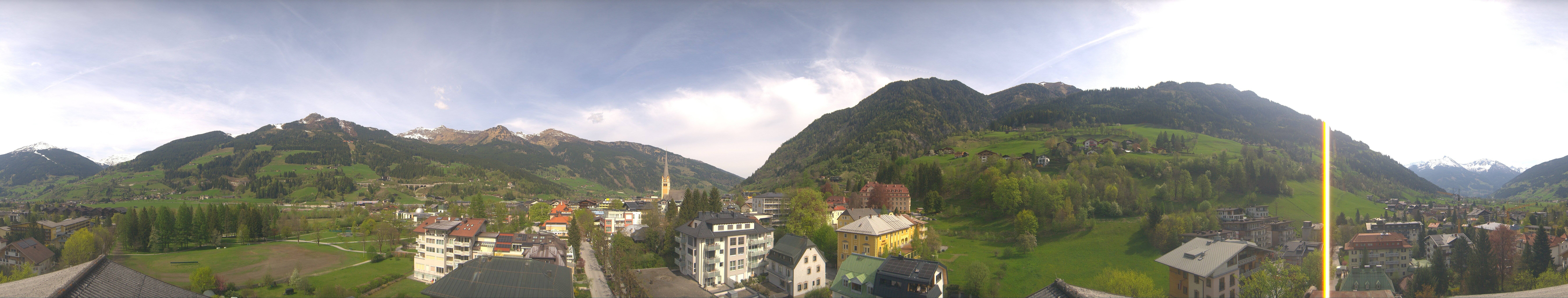 Archiv Foto Webcam Gasteinertal - Bad Hofgastein