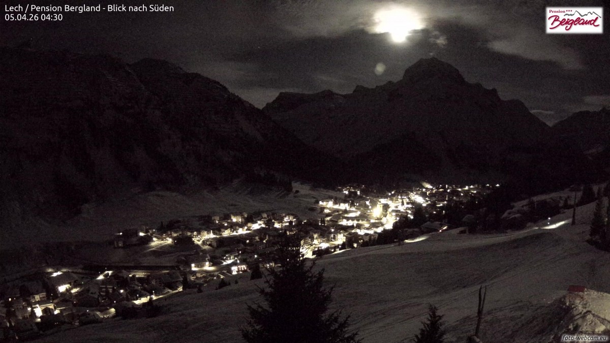 Archiv Foto Webcam Oberlech: Ausblick Pension Bergland
