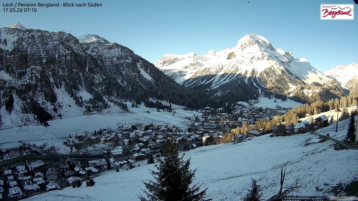 Archiv Foto Webcam Oberlech: Ausblick Pension Bergland