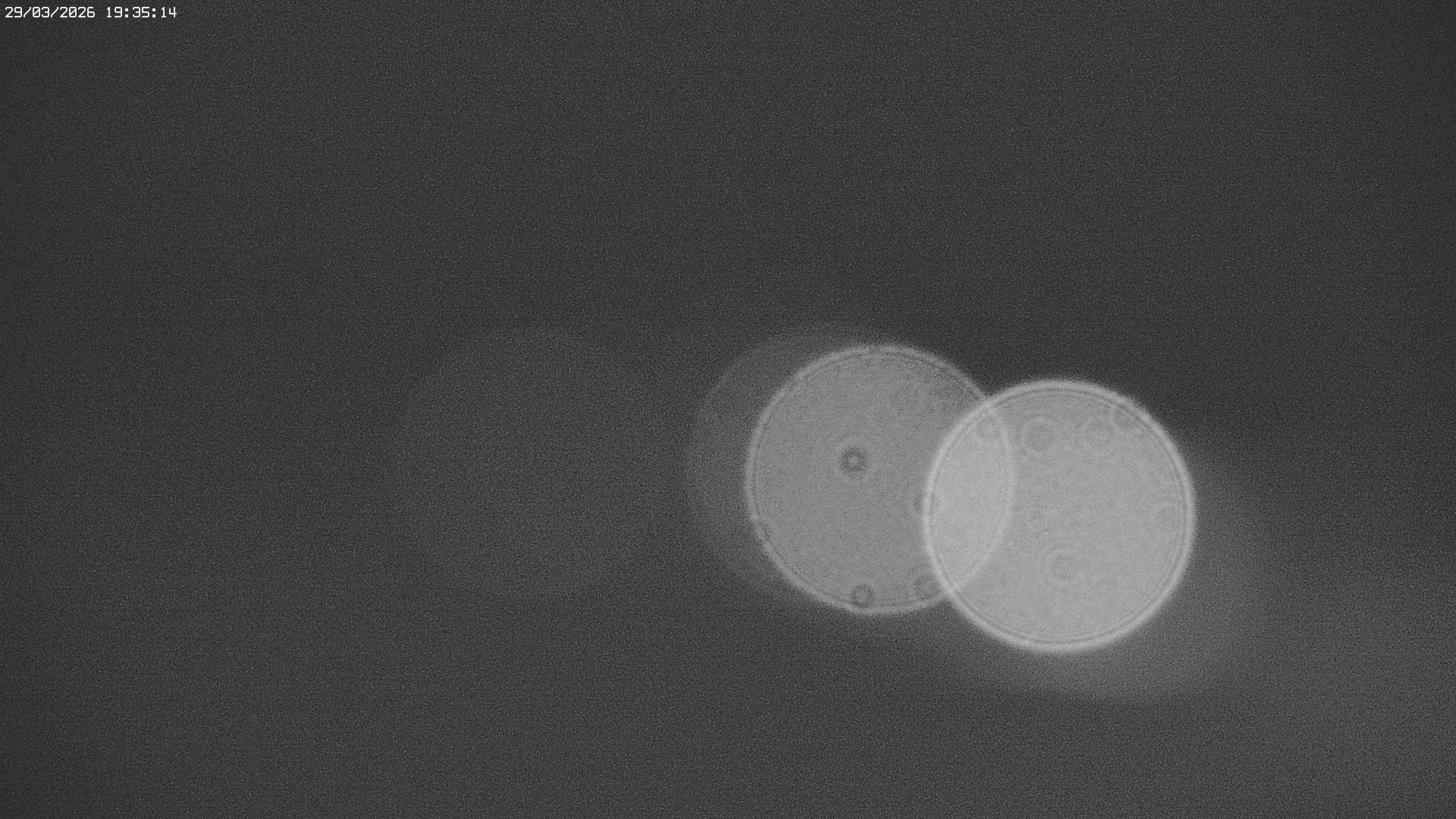 Archiv Foto Webcam Jägeralpe bei Warth